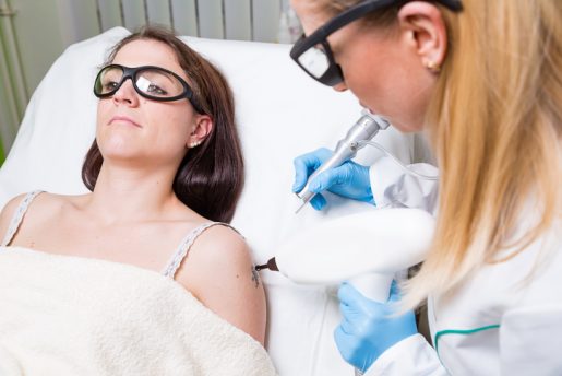 Ärztin behandelt Patientin mit Laser zur Tattooentfernung
