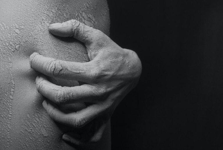 Symbolbild Nebenwirkungen von Laserbehandlungen: Eine Hand kratzt aufgeschürfte Haut