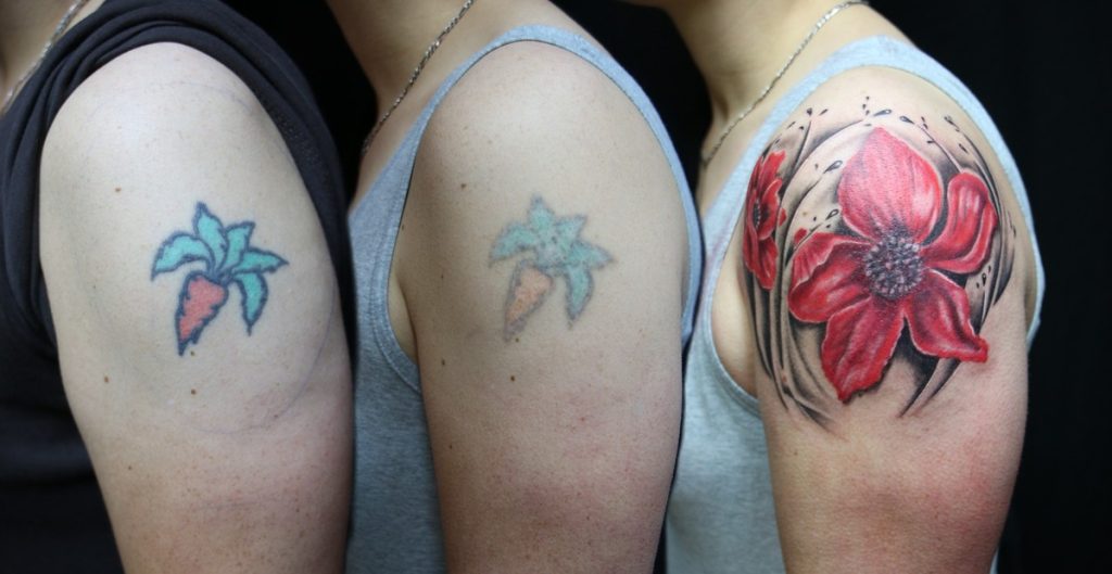Symbolbild Tattooentfernung Stuttgart: Ein buntes Tattoo auf der Schulter eines Mannes wurde per Laser behandelt und anschließend von einem neuen Tattoo gecovert.